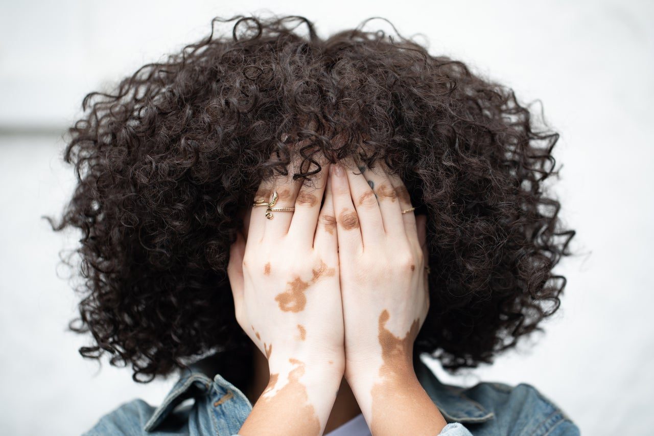 A person resting their hands over their face.